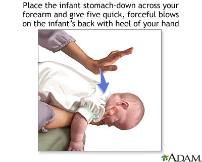 image of CPR on baby