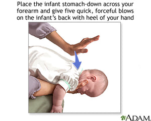 image of CPR on baby